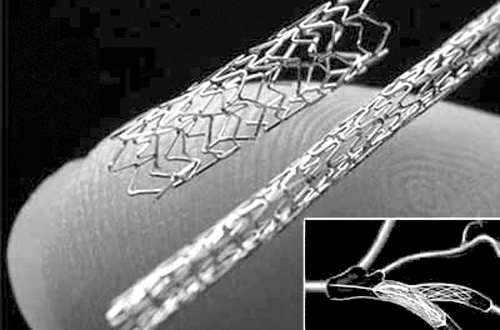 心髒支架 心髒支架