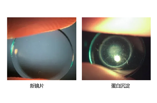 蛋白沉澱 蛋白沉澱